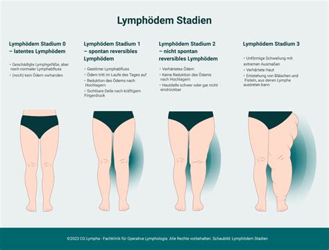 Varför får man lymfödem